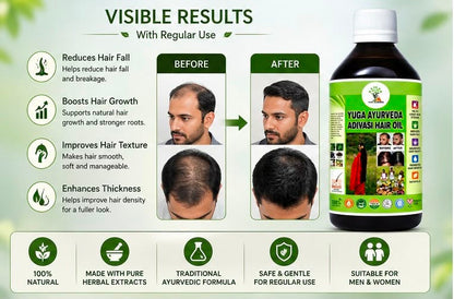 ADIVASI YUGA AYURVEDA HAIR OIL